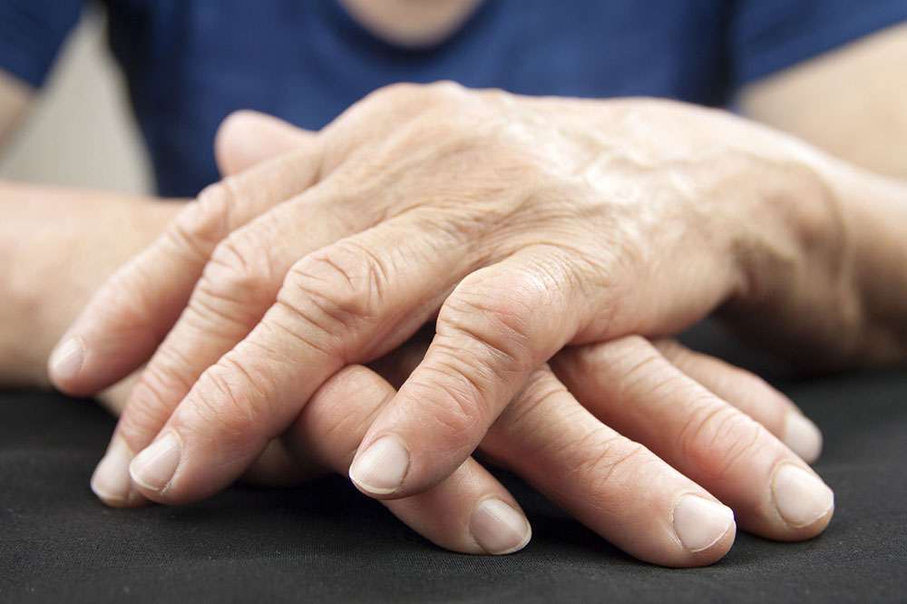 The Worst Cities for Arthritis Patients