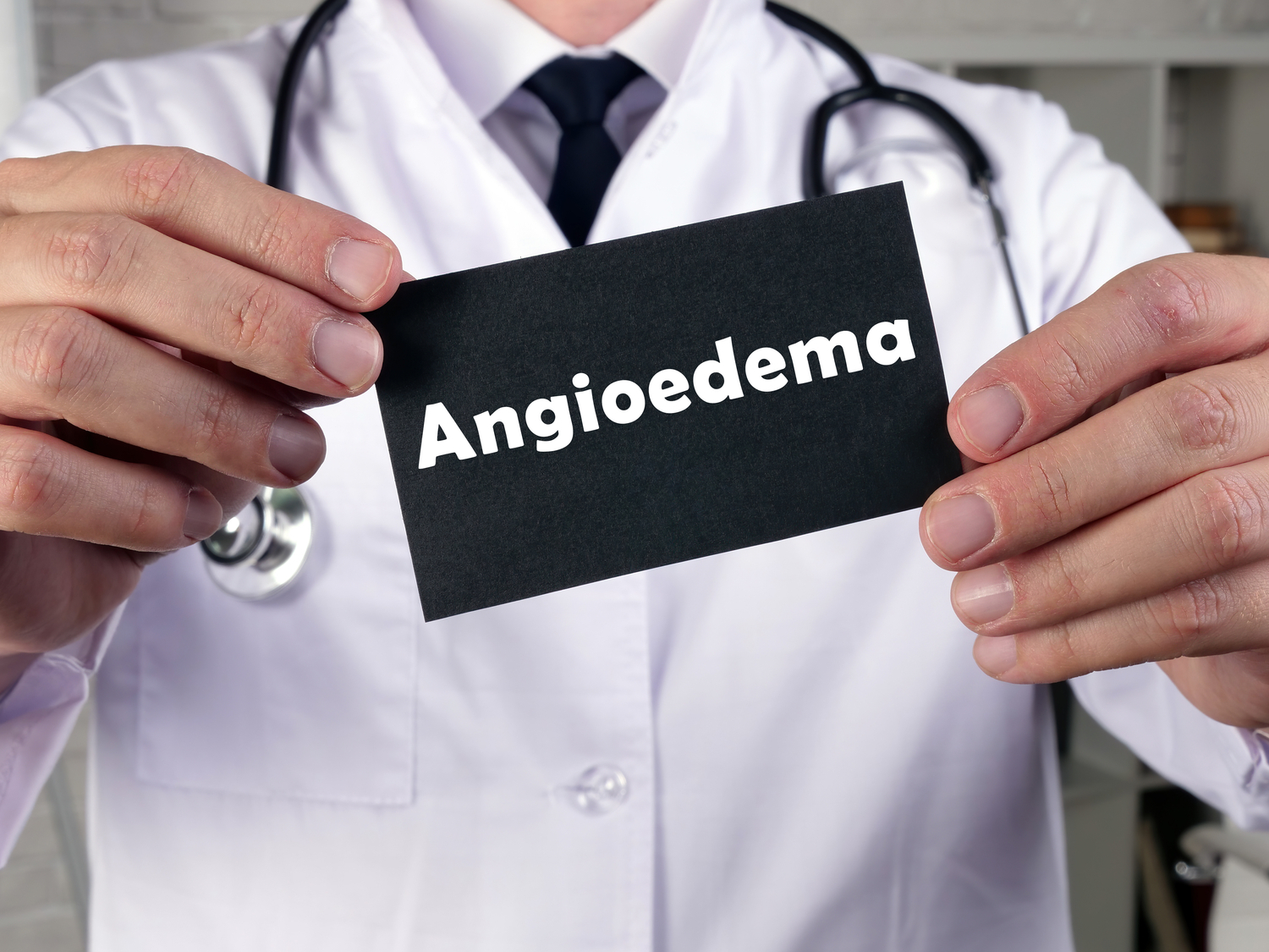 5 Foods That Should Be Avoided With Angioedema