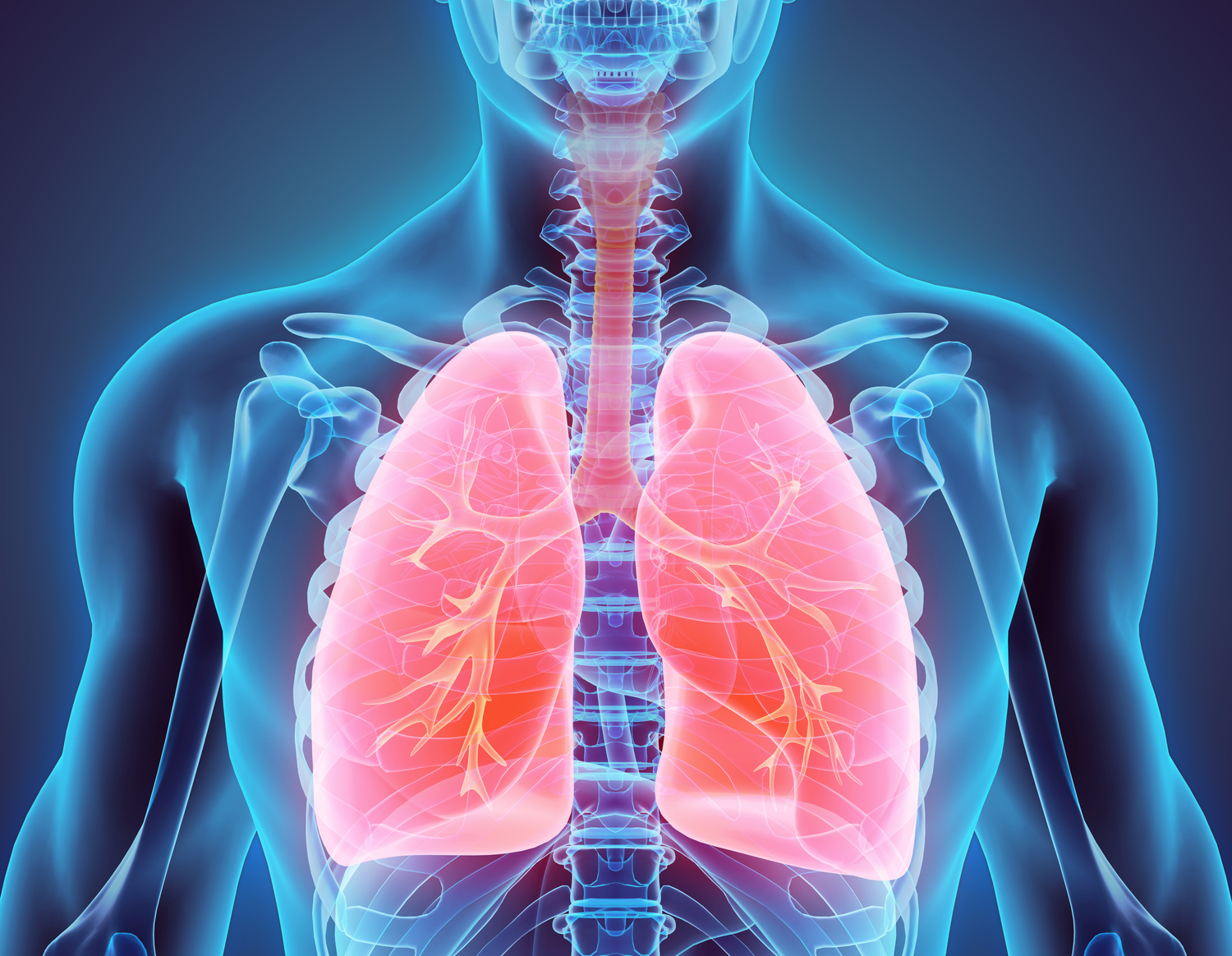 What Is Mac Lung Disease and How is it Contracted?