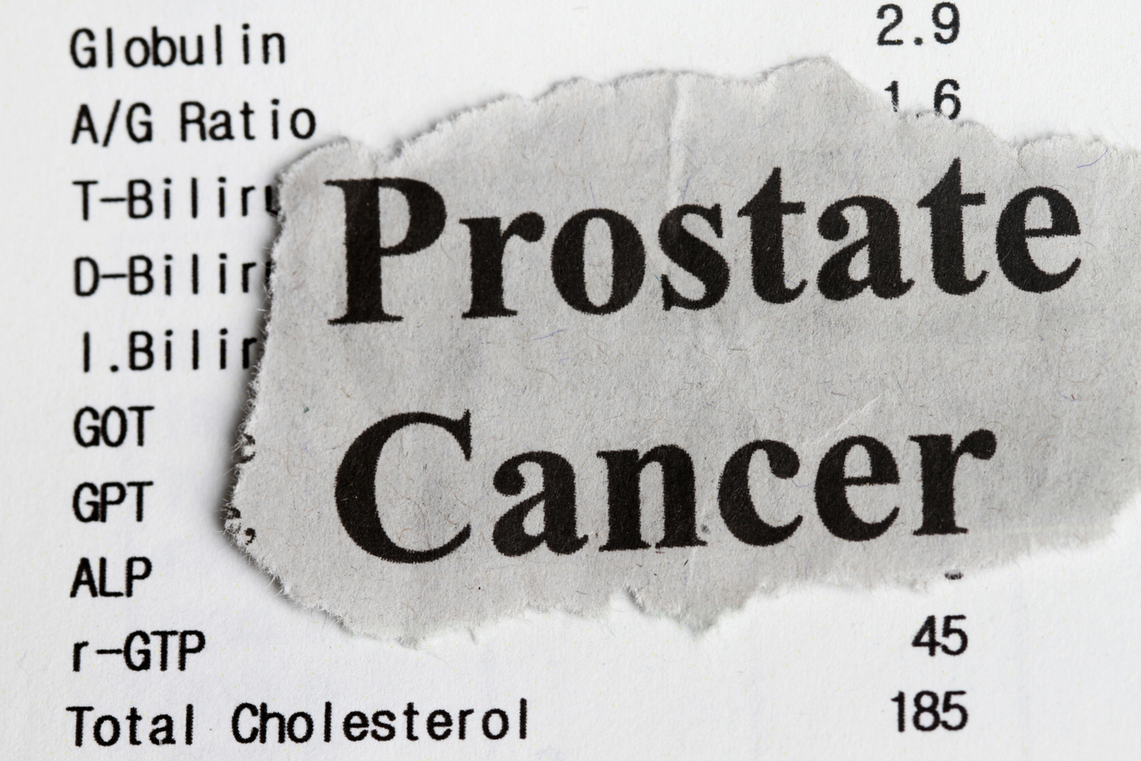 4 Early Symptoms of Prostate Cancer and Treatment Options